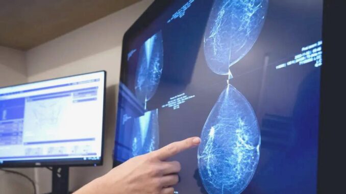 Le tecnologie di intelligenza artificiale rivoluzionano la diagnosi precoce del cancro al seno - Ferrovie 24