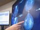 Le tecnologie di intelligenza artificiale rivoluzionano la diagnosi precoce del cancro al seno - Ferrovie 24